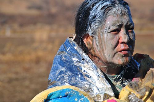 A No-DAPL activist dowsed with Milk of Magnesia to ward off effects of pepper spray - photograph by C.S. Hagen