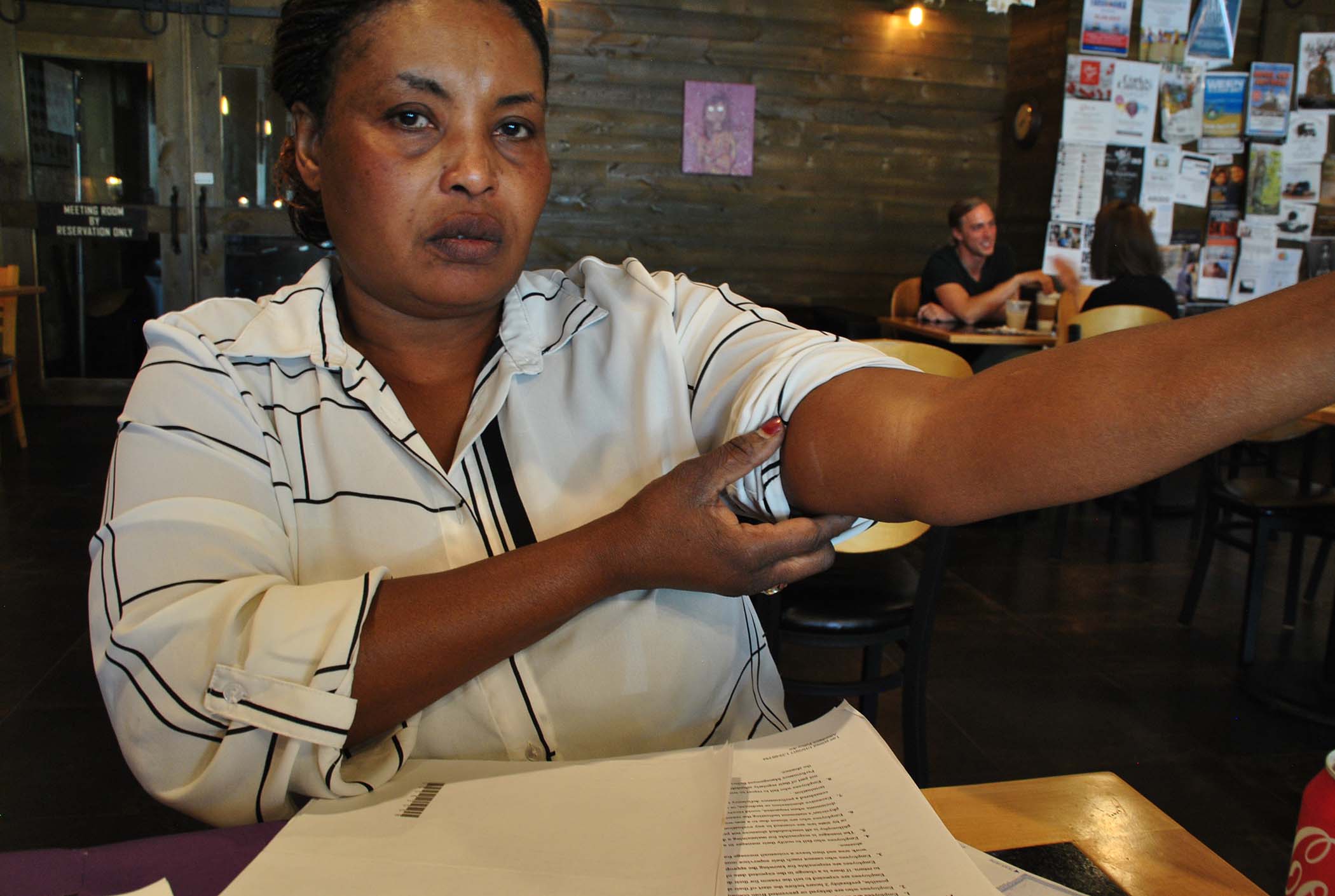 Halima Kwcrwb shows her arm where she says it was sprained last year - photo by C.S. Hagen